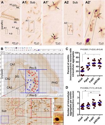 Intraneuronal sortilin aggregation relative to granulovacuolar degeneration, tau pathogenesis and sorfra plaque formation in human hippocampal formation